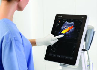 Преимущества использования портативных аппаратов УЗИ Преимущества использования портативных аппаратов УЗИ