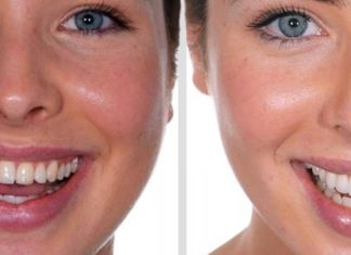 Какая отбеливающая зубная паста подойдет лучше всего? Итак, что делать, чтобы зубы были белыми Какая отбеливающая зубная паста подойдет лучше всего? Итак, что делать, чтобы зубы были белыми.