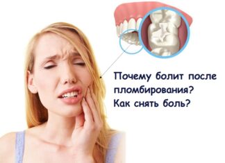 Причины боли после установки пломбы Причины боли после установки пломбы