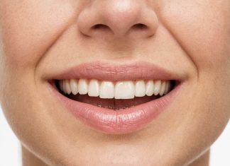 Как предотвратить пародонтит