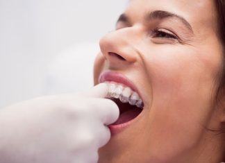 Капы (элайнеры) Инвизилайн: невидимый путь к идеальным зубам