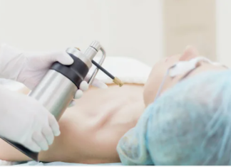 Криодеструкция новообразований: современный метод удаления холодом